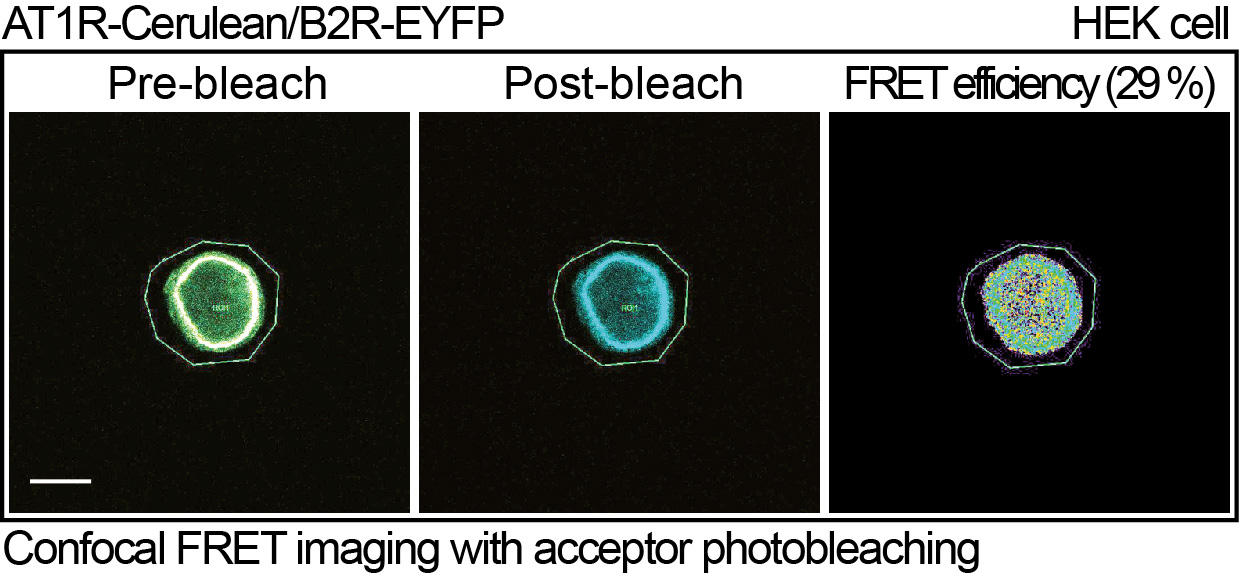 Enlarged view: FRET-cell